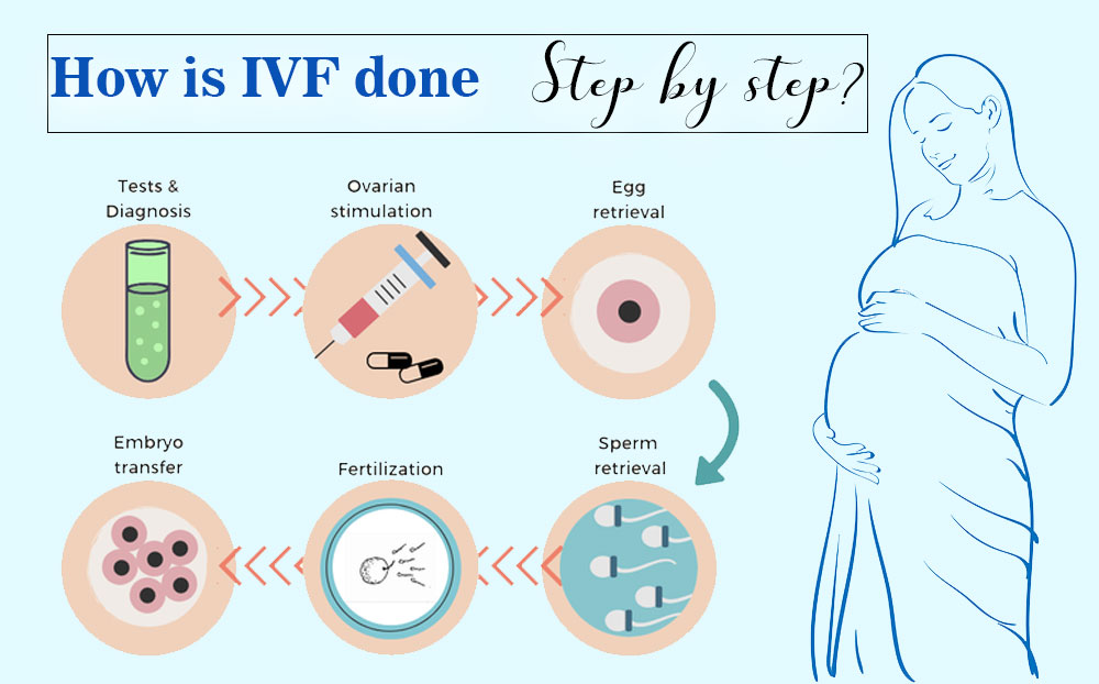 IVF treatment in cyprus