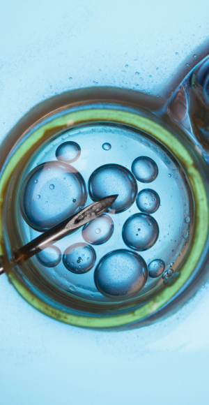 IVF
