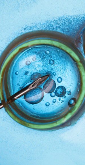 IVF - הפריה חוץ גופית