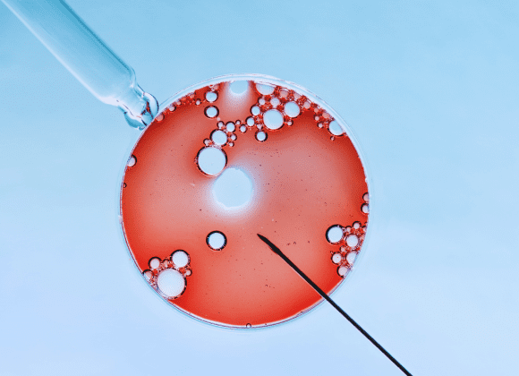 טיפול IVF הפריה חוץ גופית