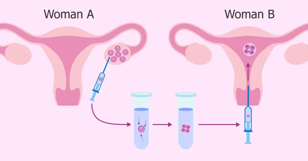 Reciprocal IVF and shared motherhood